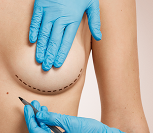 Chirurgie estetică intimă pentru sănătatea femeii, oferită de SuperAGE by NORD